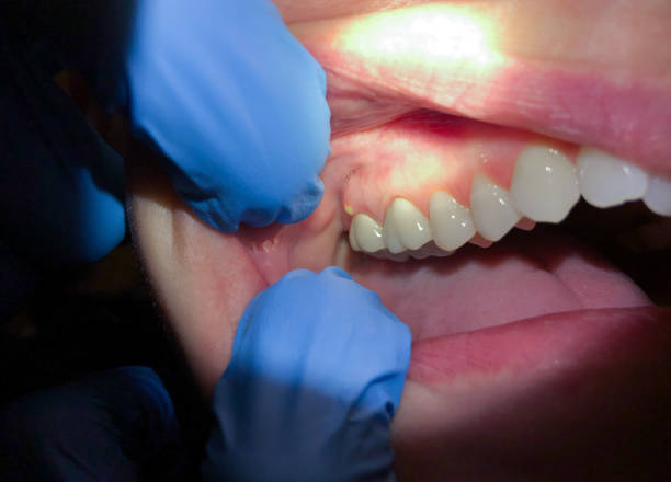 Best 24-Hour Emergency Dental Care in San Juan Pistrano, CA